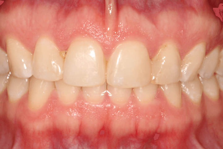 After treatment: Adult patient